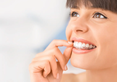 woman-wearing-invisalign-574a00f82b59a51aa5a3540cf1341bb0